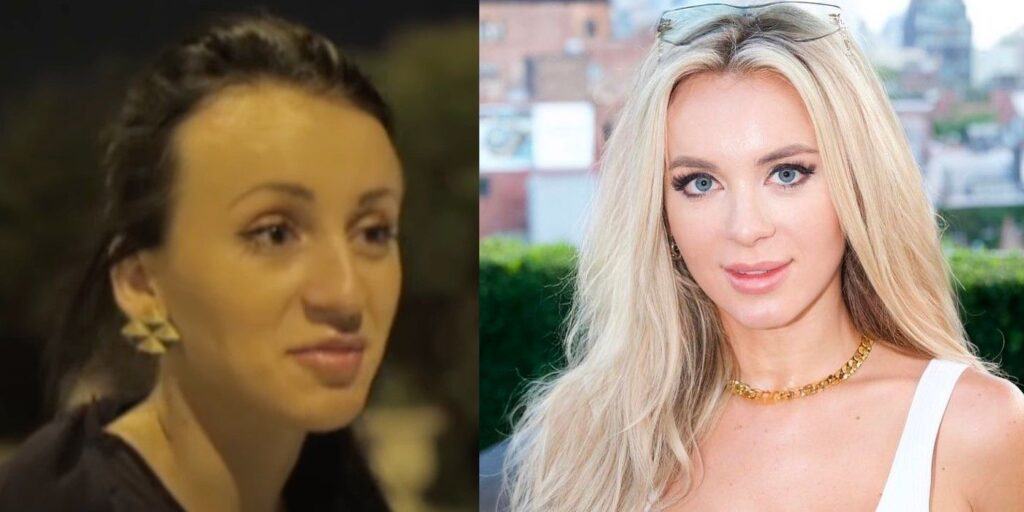 How 90 Day Fiancé's Yara's Face Changed After Plastic Surgery Makeover ...